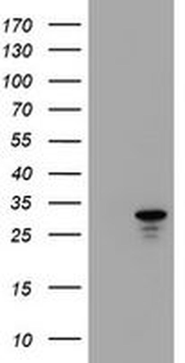 HDHD1 Antibody in Western Blot (WB)