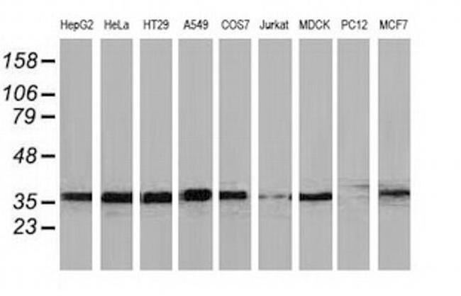 UBXN2B Antibody in Western Blot (WB)