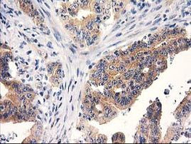 RTN4IP1 Antibody in Immunohistochemistry (Paraffin) (IHC (P))