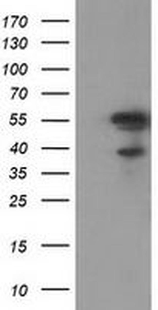 KATNAL1 Antibody in Western Blot (WB)