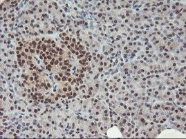 POLR2E Antibody in Immunohistochemistry (Paraffin) (IHC (P))