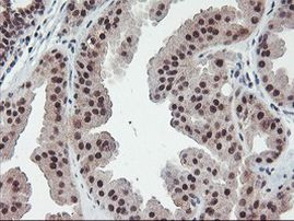 POLR2E Antibody in Immunohistochemistry (Paraffin) (IHC (P))