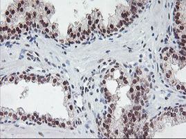 POLR2E Antibody in Immunohistochemistry (Paraffin) (IHC (P))