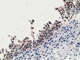 15-PGDH Antibody in Immunohistochemistry (Paraffin) (IHC (P))