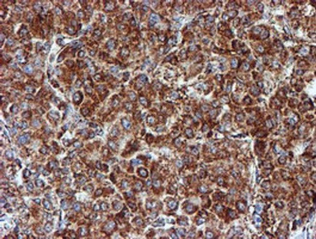 NDUFB9 Antibody in Immunohistochemistry (Paraffin) (IHC (P))