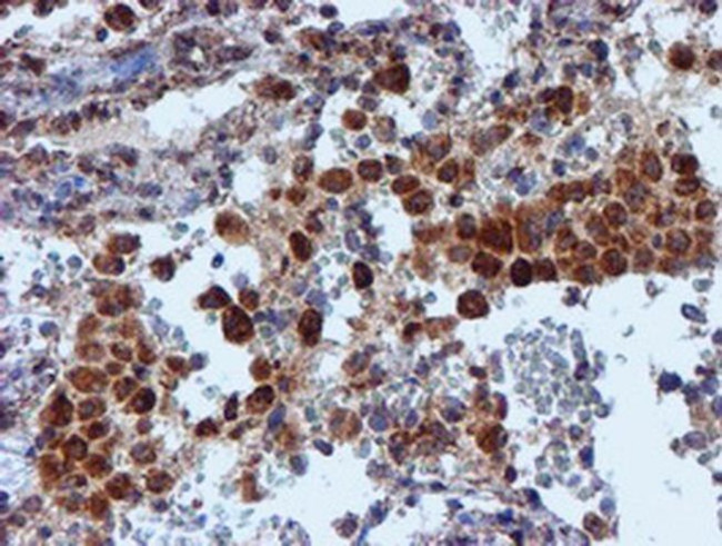 NDUFB9 Antibody in Immunohistochemistry (Paraffin) (IHC (P))