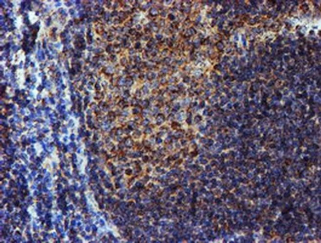 NDUFB9 Antibody in Immunohistochemistry (Paraffin) (IHC (P))