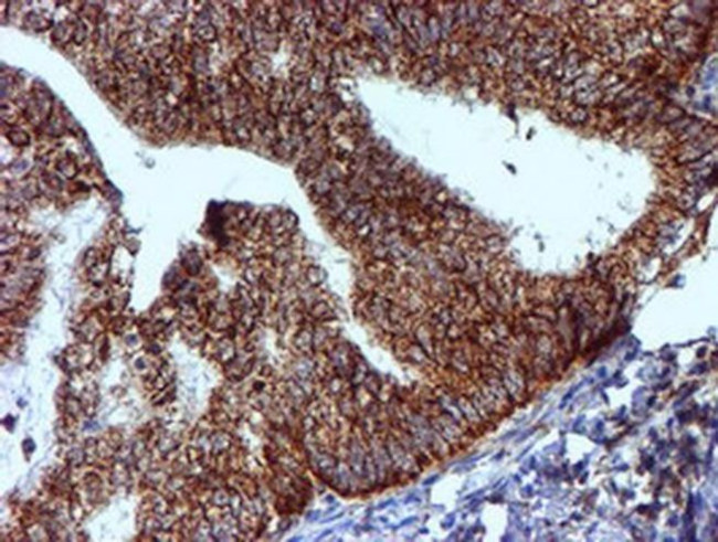 NDUFB9 Antibody in Immunohistochemistry (Paraffin) (IHC (P))