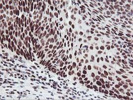 HOXC11 Antibody in Immunohistochemistry (Paraffin) (IHC (P))