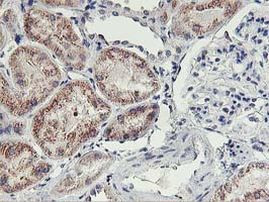 HOXC11 Antibody in Immunohistochemistry (Paraffin) (IHC (P))