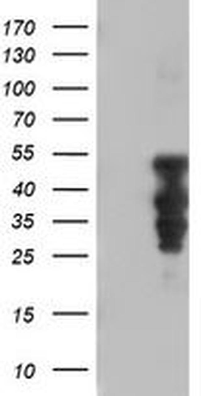 HOXC11 Antibody in Western Blot (WB)