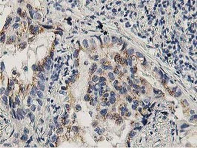 LACTB2 Antibody in Immunohistochemistry (Paraffin) (IHC (P))