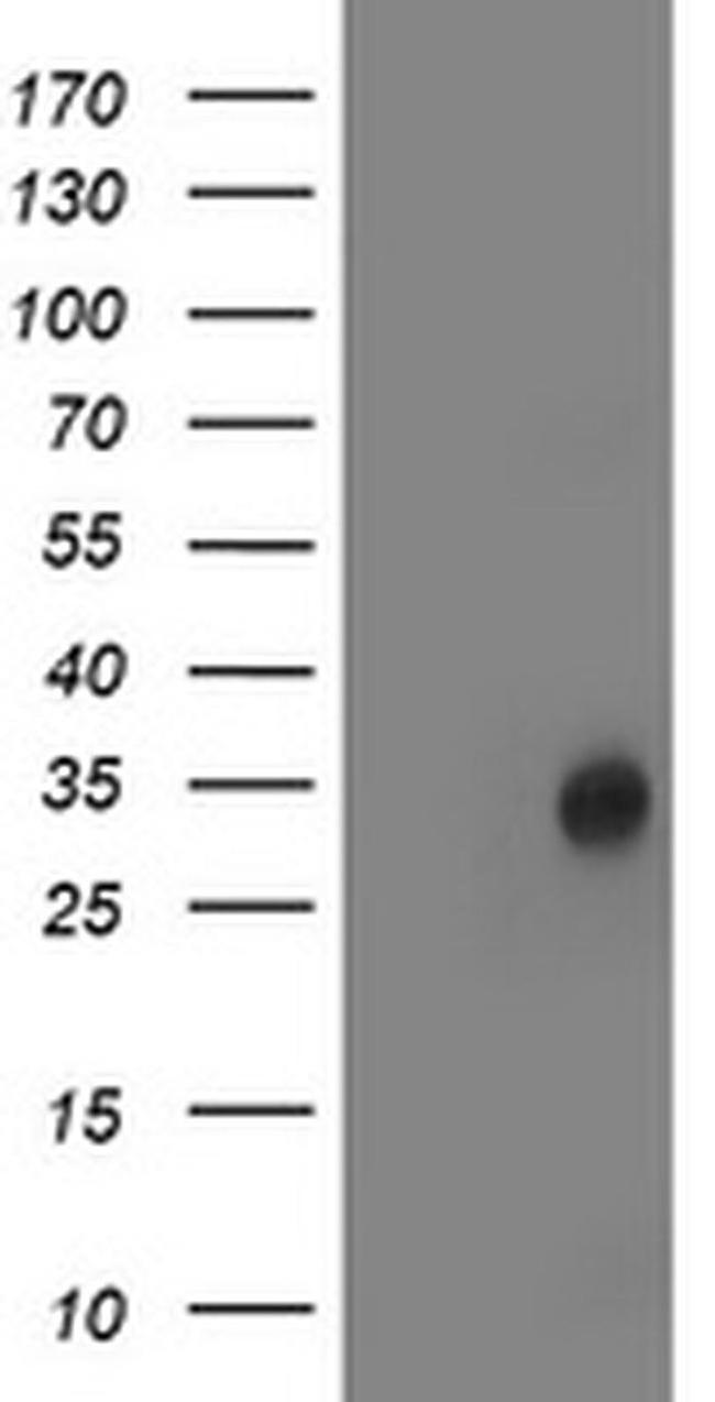 LACTB2 Antibody in Western Blot (WB)