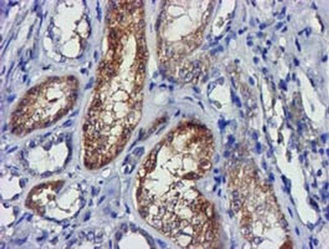 LACTB2 Antibody in Immunohistochemistry (Paraffin) (IHC (P))