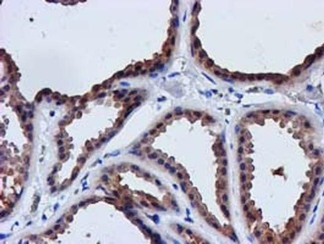 LACTB2 Antibody in Immunohistochemistry (Paraffin) (IHC (P))