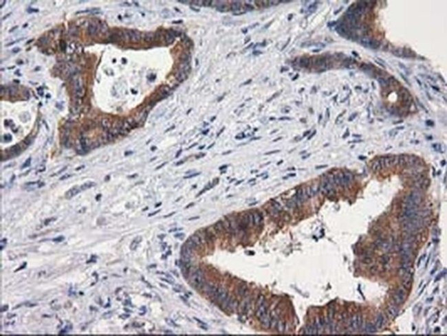 GBA3 Antibody in Immunohistochemistry (Paraffin) (IHC (P))