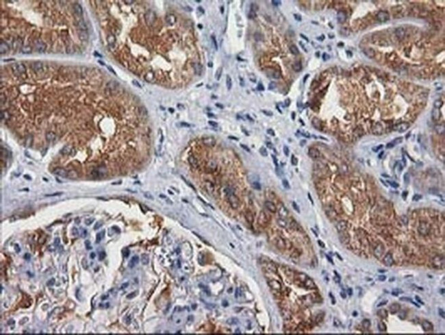 GBA3 Antibody in Immunohistochemistry (Paraffin) (IHC (P))