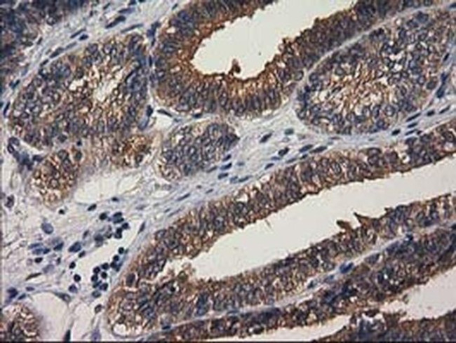 GBA3 Antibody in Immunohistochemistry (Paraffin) (IHC (P))