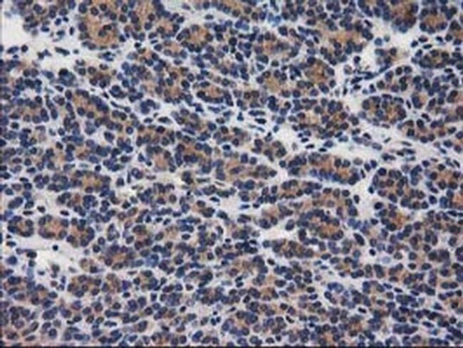 GBA3 Antibody in Immunohistochemistry (Paraffin) (IHC (P))