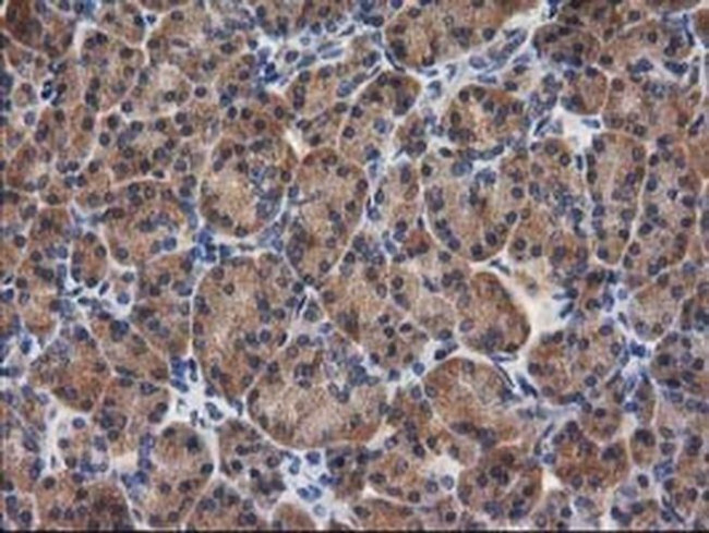 GBA3 Antibody in Immunohistochemistry (Paraffin) (IHC (P))