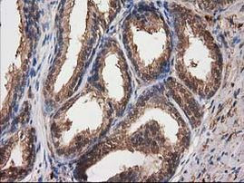 Destrin Antibody in Immunohistochemistry (Paraffin) (IHC (P))