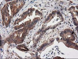 Destrin Antibody in Immunohistochemistry (Paraffin) (IHC (P))