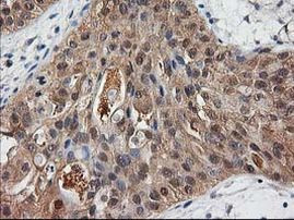 Destrin Antibody in Immunohistochemistry (Paraffin) (IHC (P))