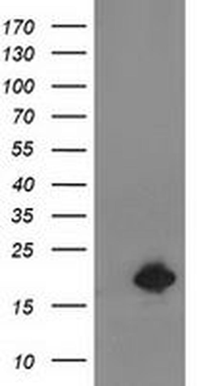 Destrin Antibody in Western Blot (WB)