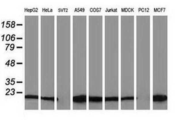 Destrin Antibody in Western Blot (WB)