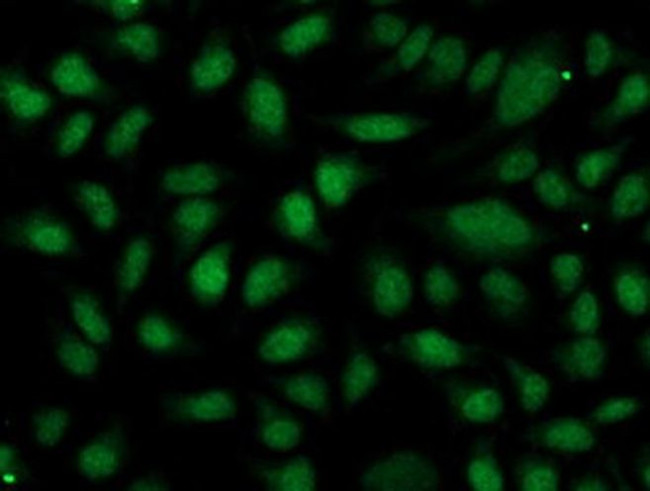 OGFOD1 Antibody in Immunocytochemistry (ICC/IF)