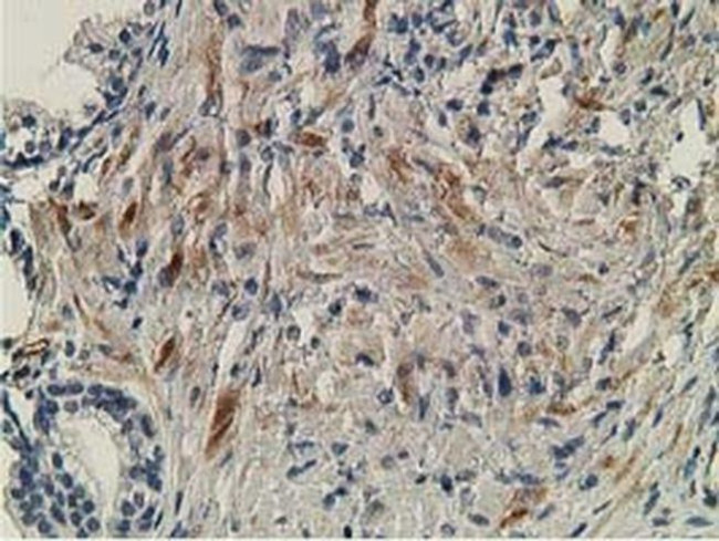 OGFOD1 Antibody in Immunohistochemistry (Paraffin) (IHC (P))