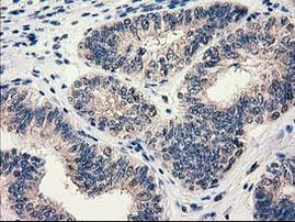 HDHD1 Antibody in Immunohistochemistry (Paraffin) (IHC (P))