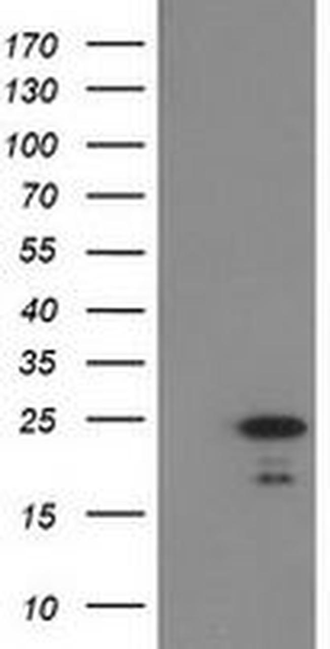 HDHD1 Antibody in Western Blot (WB)