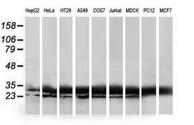 HDHD1 Antibody in Western Blot (WB)