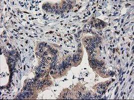 MEF2C Antibody in Immunohistochemistry (Paraffin) (IHC (P))