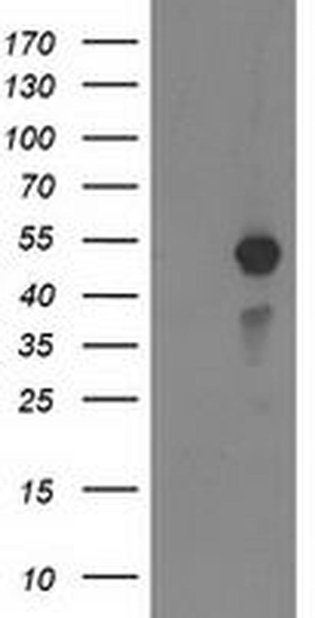 MEF2C Antibody in Western Blot (WB)