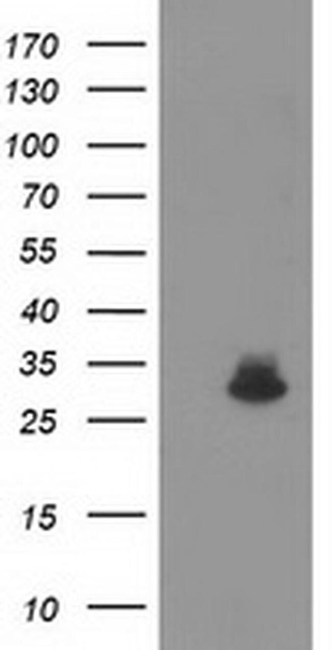 KCTD14 Antibody in Western Blot (WB)