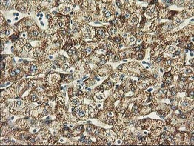 Beclin 1 Antibody in Immunohistochemistry (Paraffin) (IHC (P))