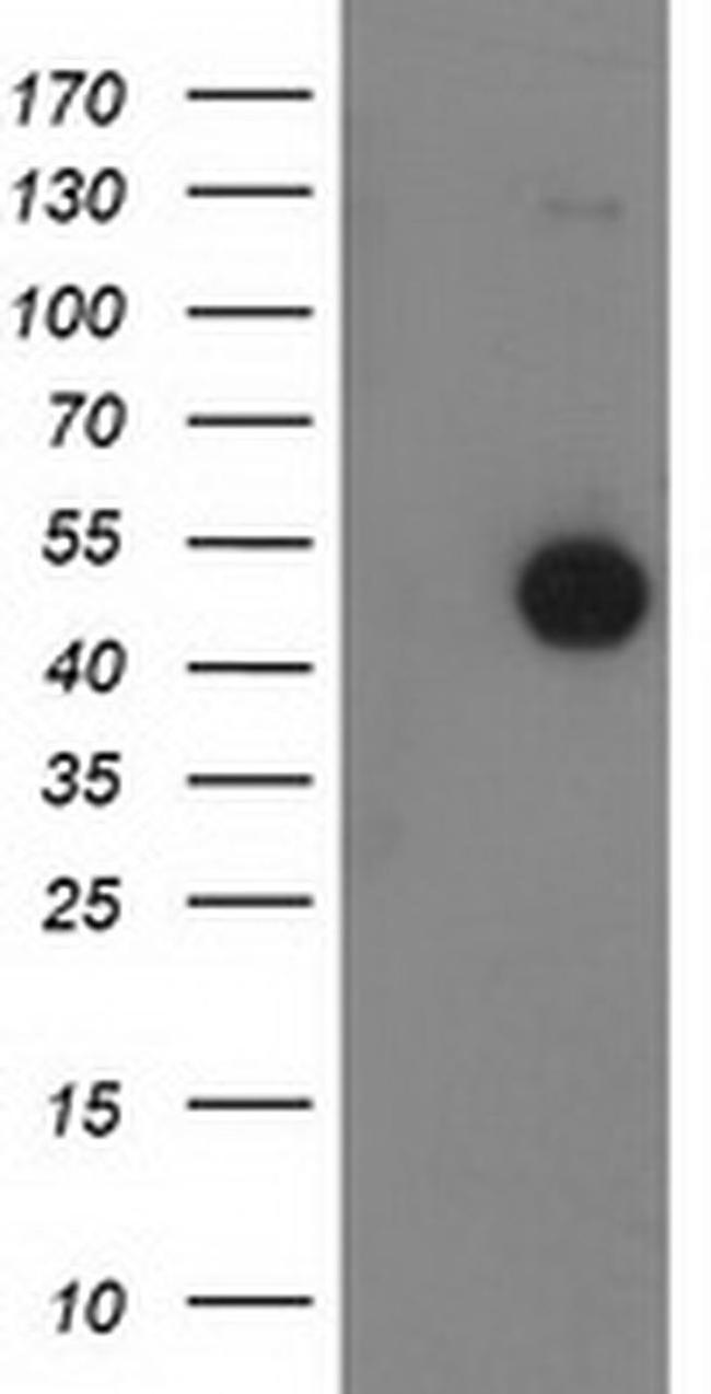 Beclin 1 Antibody in Western Blot (WB)