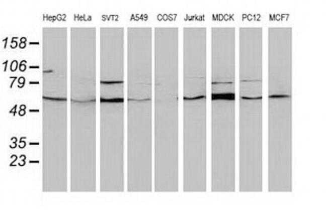 Beclin 1 Antibody in Western Blot (WB)