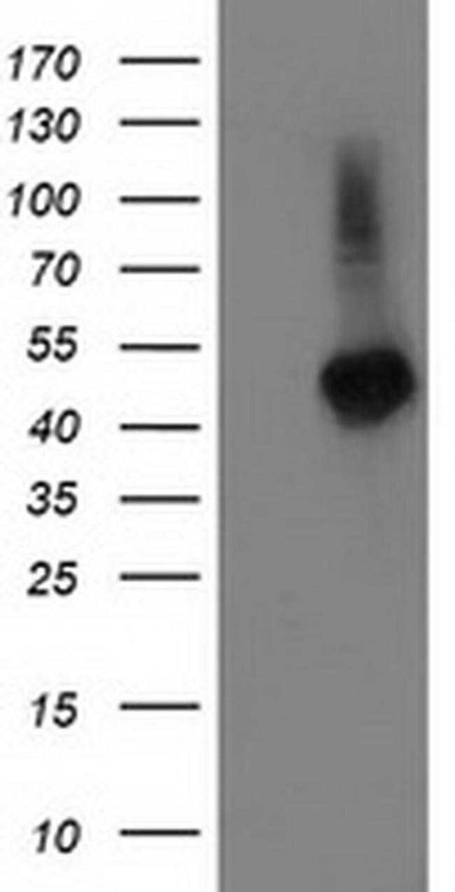 TBCEL Antibody in Western Blot (WB)