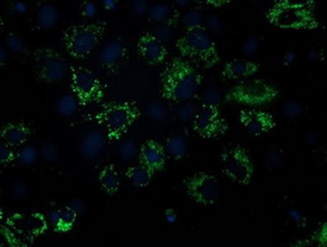 NDUFA7 Antibody in Immunocytochemistry (ICC/IF)