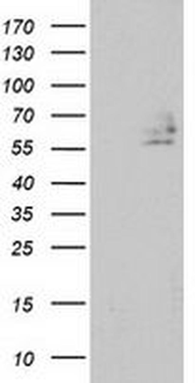 DEF8 Antibody in Western Blot (WB)