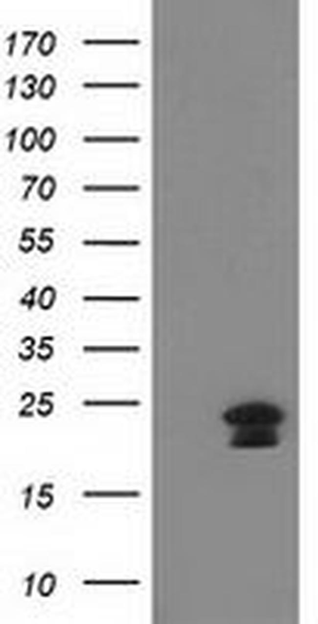 HAND1 Antibody in Western Blot (WB)