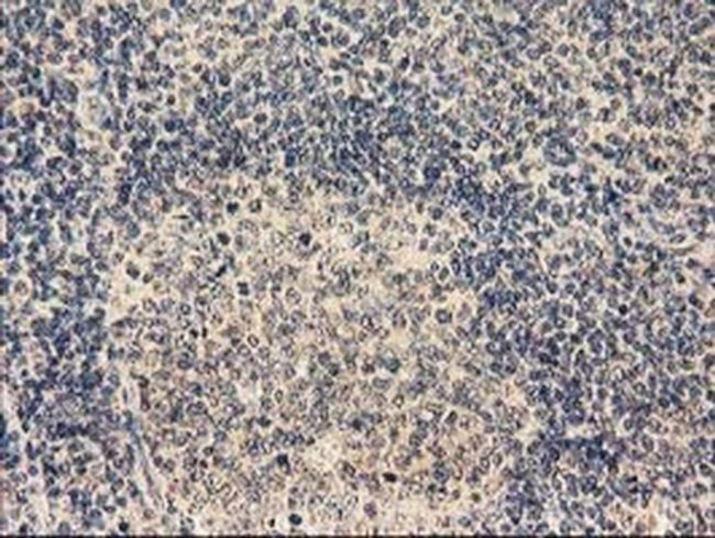 TBCEL Antibody in Immunohistochemistry (Paraffin) (IHC (P))