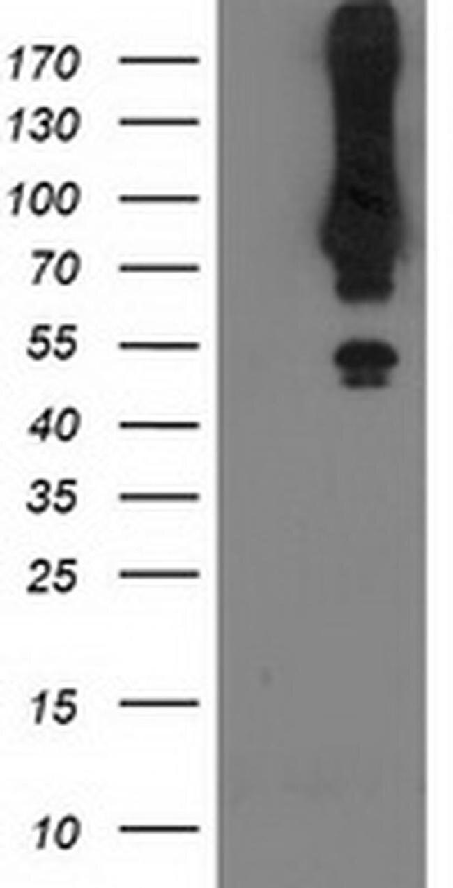 MGRN1 Antibody in Western Blot (WB)