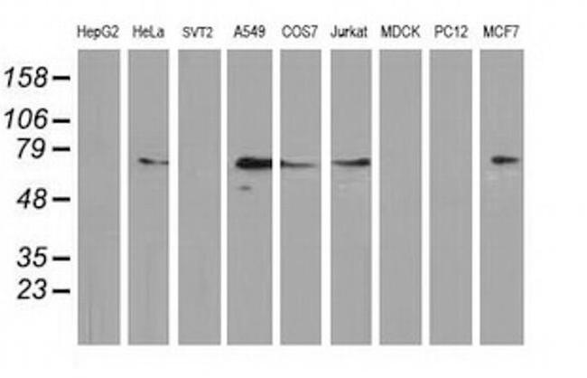 MGRN1 Antibody in Western Blot (WB)