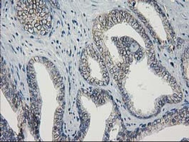 GUK1 Antibody in Immunohistochemistry (Paraffin) (IHC (P))