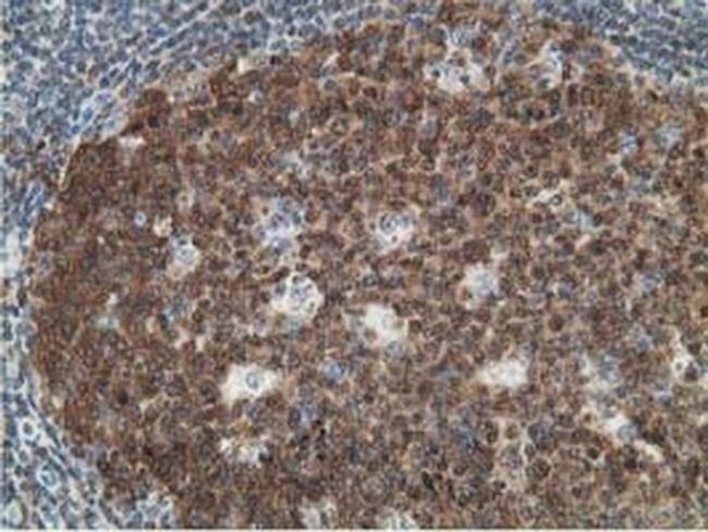 DCK Antibody in Immunohistochemistry (Paraffin) (IHC (P))