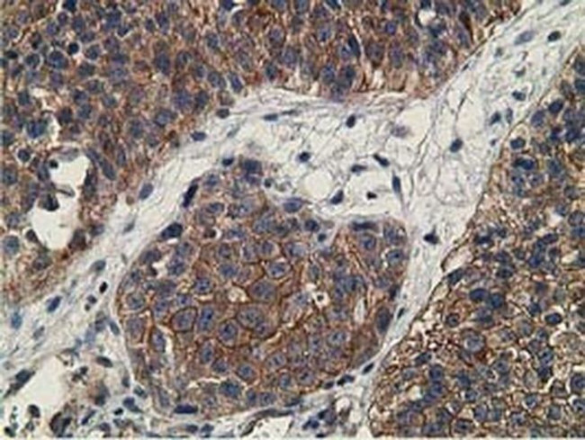 CCNB1IP1 Antibody in Immunohistochemistry (Paraffin) (IHC (P))